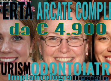 Offerta arcate complete implantologia dentale