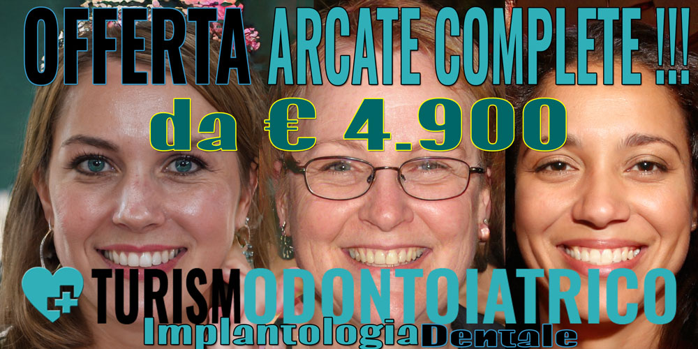 Offerta arcate complete implantologia dentale